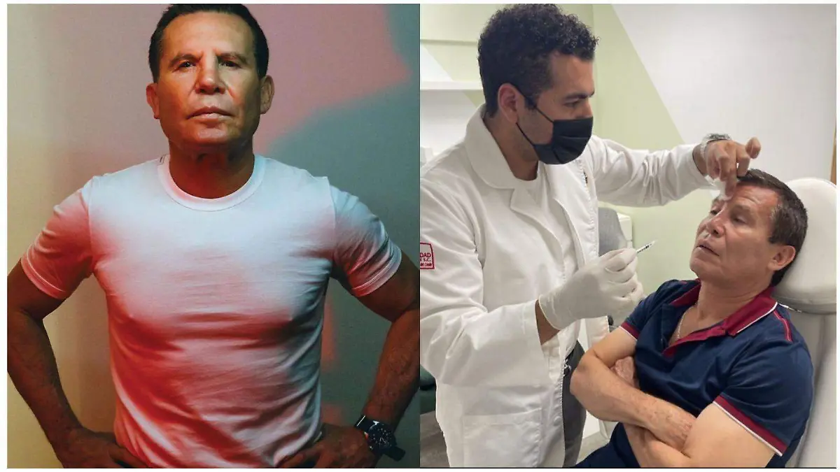 Julio cesar Chavez se arreglo estetico en el rostro y le llueven criticas